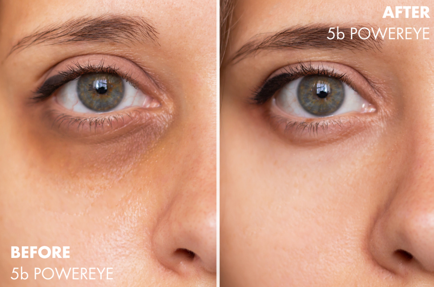 5b POWEREYE multi-benefit eye cream